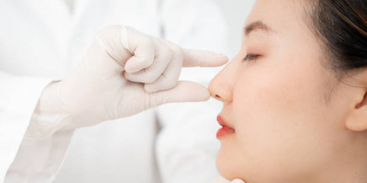 Rhinoplasty in Dubai for Wide Nasal Bones: Osteotomy Guide