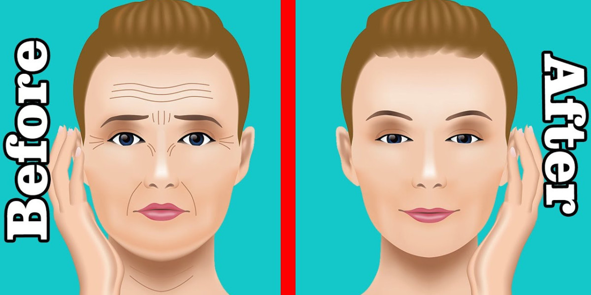Einführung in Baby Botox und moderne ästhetische Trends