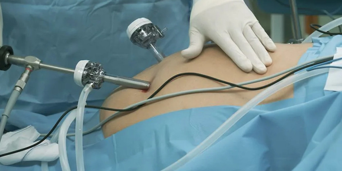 Everything You Need to Know About Laparoscopic Surgery in Islamabad
