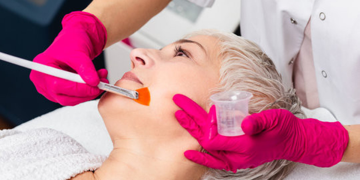 Why Chemical Peels in Islamabad Are Trending Among Young Adults