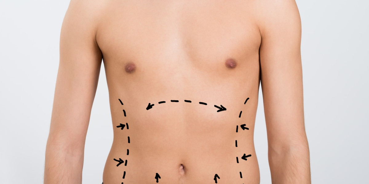 Can Men Benefit from Tummy Tuck Surgery?