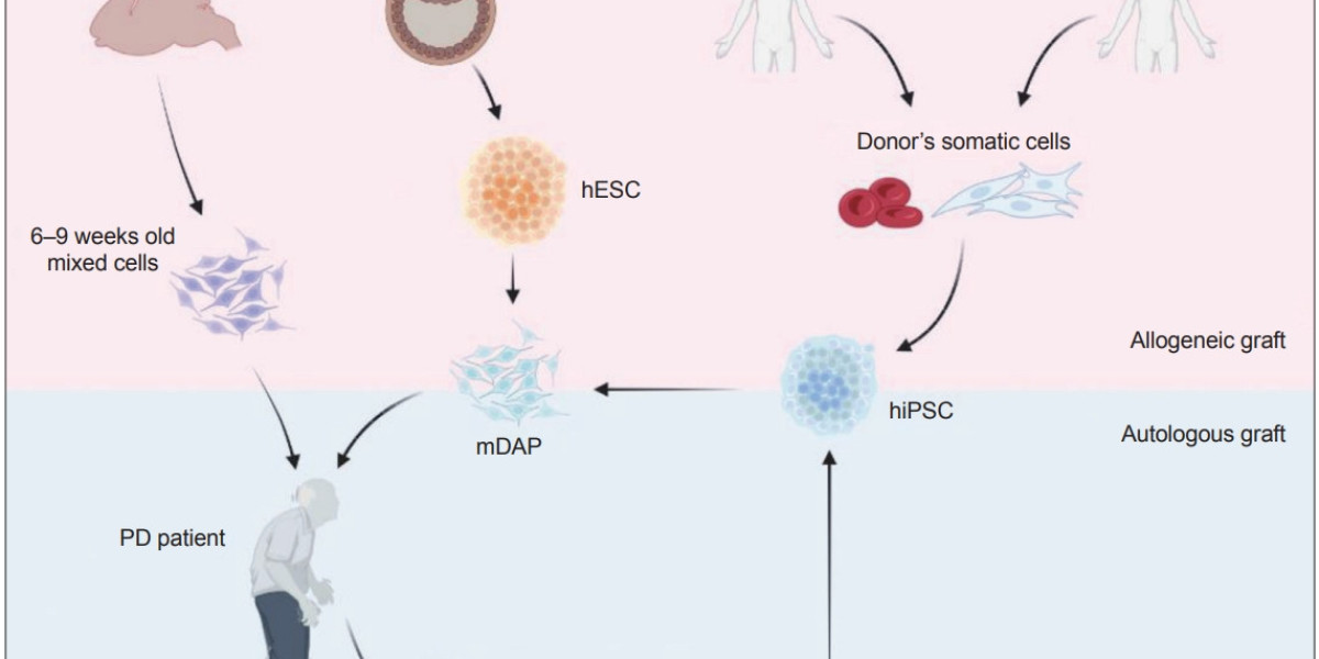 Stem Cell Therapy for Parkinson's Disease: What to Know