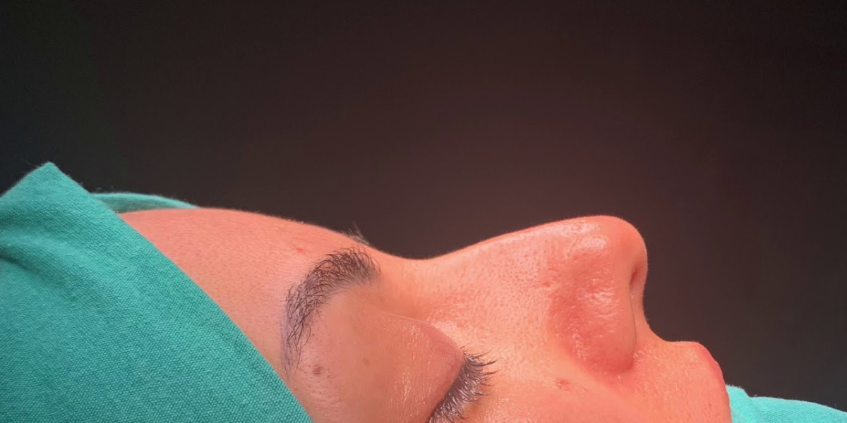 Understanding Rhinoplasty Cost in Pakistan Explained: Factors That Shape Pricing
