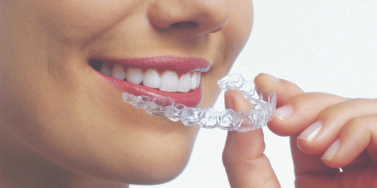 Best Invisalign Provider in Bikaner: How to Choose the Right Expert for Your Smile Transformation