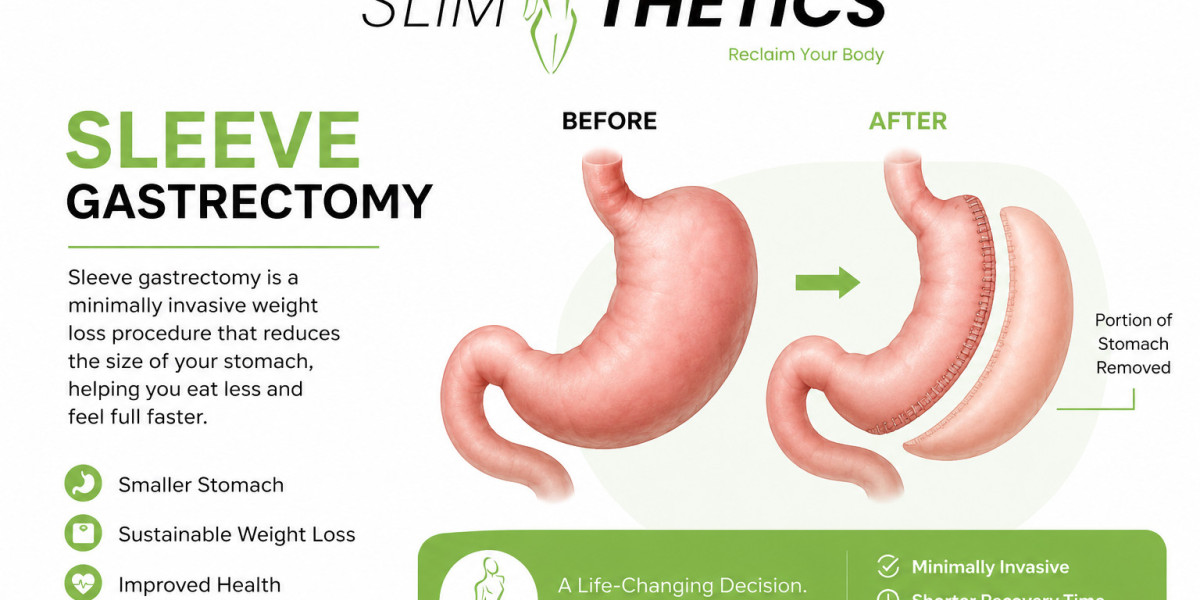How Much Weight Can You Lose After Sleeve Gastrectomy in Islamabad?  