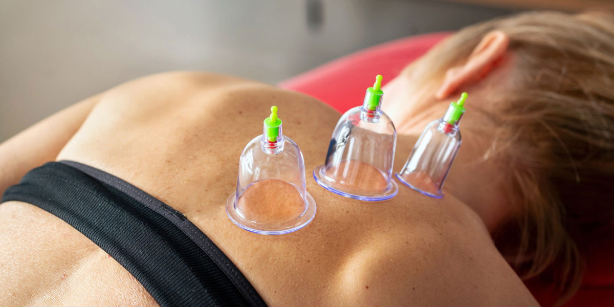 Dry Cupping: For Celebrities and You