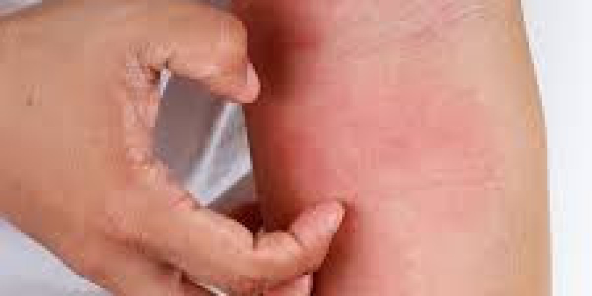 Bacterial Infection vs Fungal Infection: Understanding the Key Differences