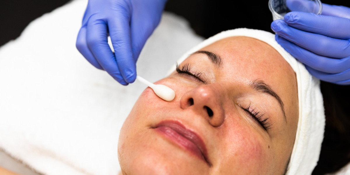 How Chemical Peels Refresh Your Face?