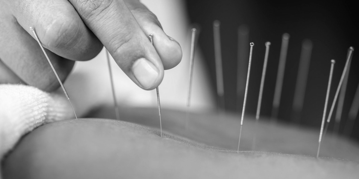 Natural Acupuncture Caulfield Solutions for Pain and Wellness