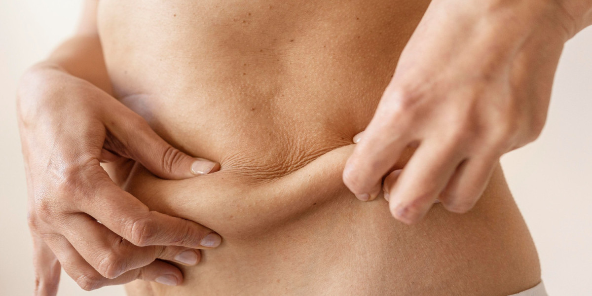 Best Liposuction Surgeon in Dubai Offering Personalized Treatment Plans