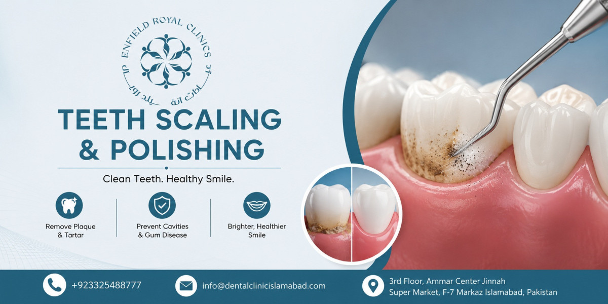 Expert Dental Scaling Services in Islamabad