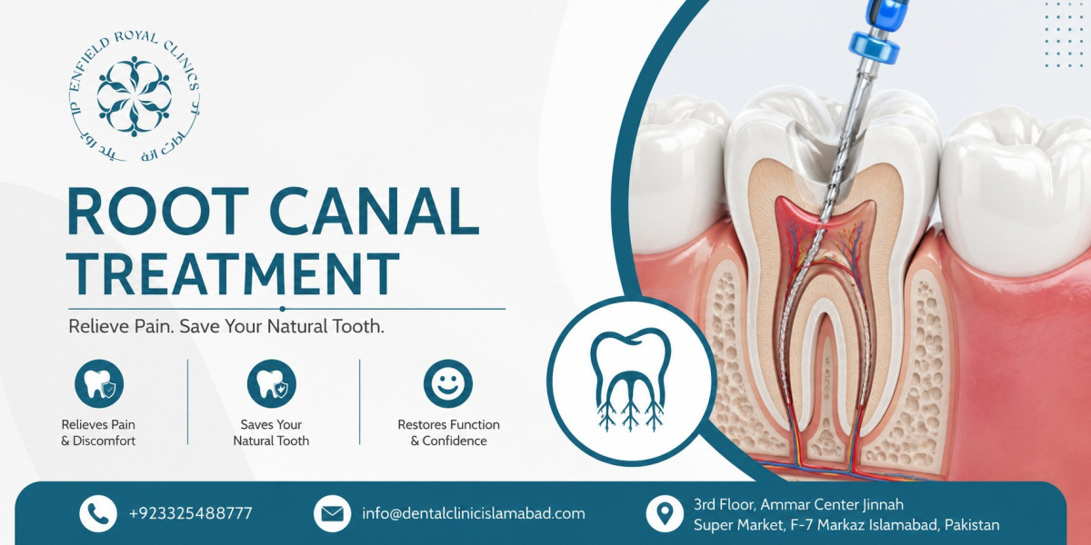 Affordable and Reliable Root Canal Treatment in Islamabad