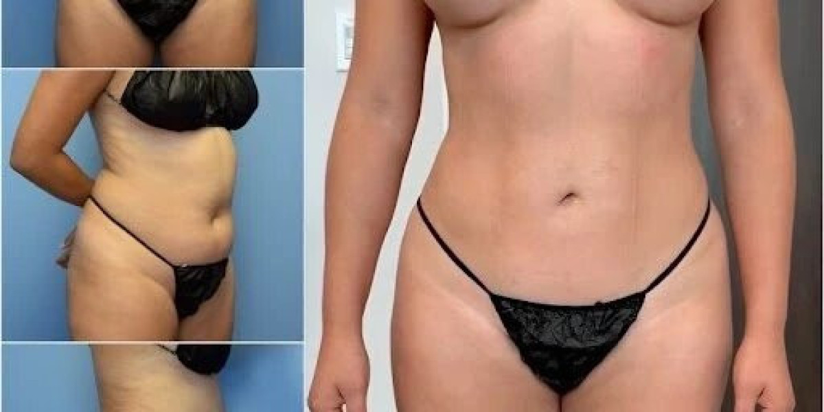 Body Contouring in Dubai: Your Roadmap to Enhanced Body Confidence