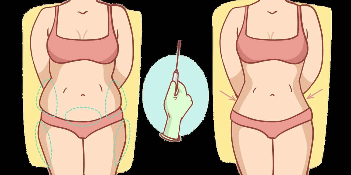 Liposuction vs. Tummy Tuck: Which Procedure Should You Choose?