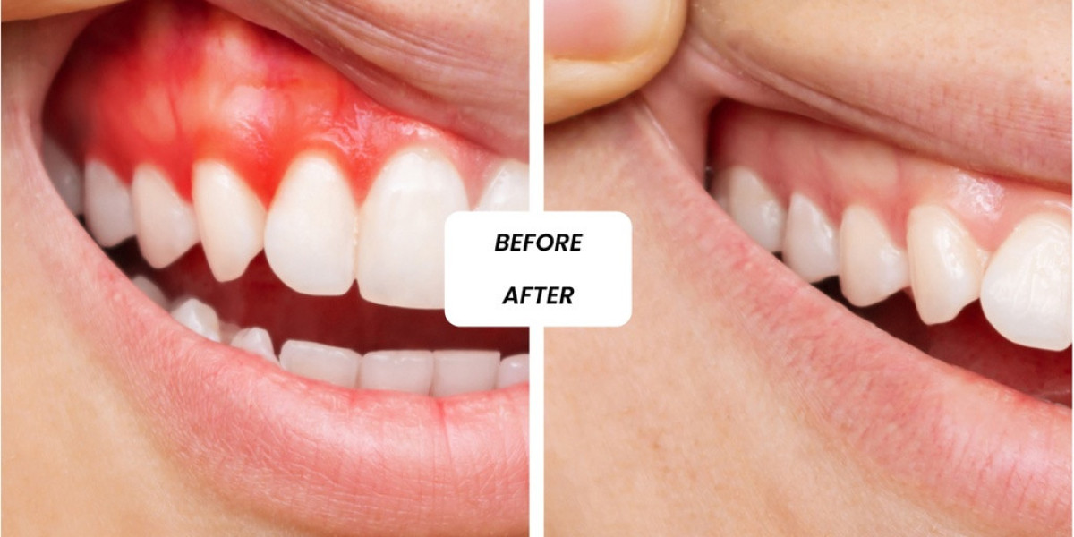 Cosmetic Dentistry in Dubai: Beautiful Smiles with Personalized Dental Care