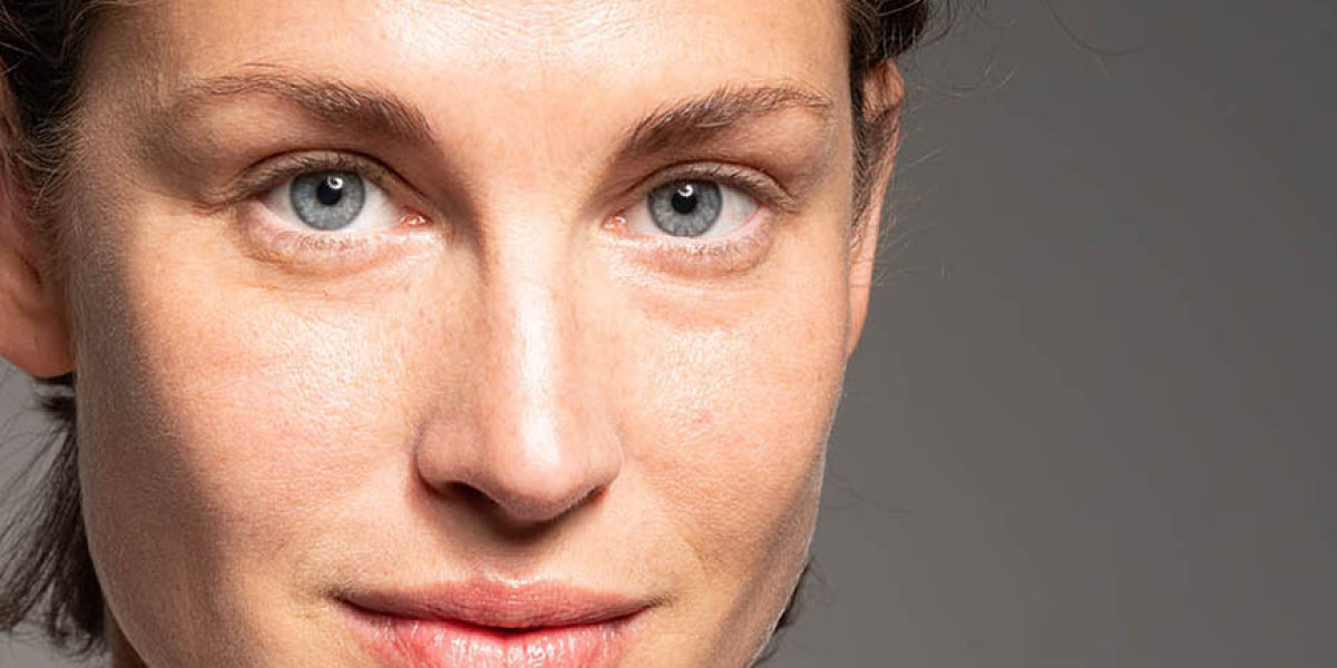 Upper Eyelid Surgery in London: What Happens During the Consultation?