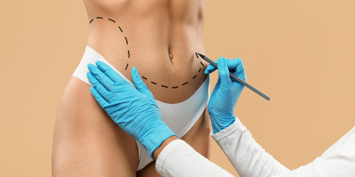 How Liposuction in Dubai Fits Modern Body Shaping Goals