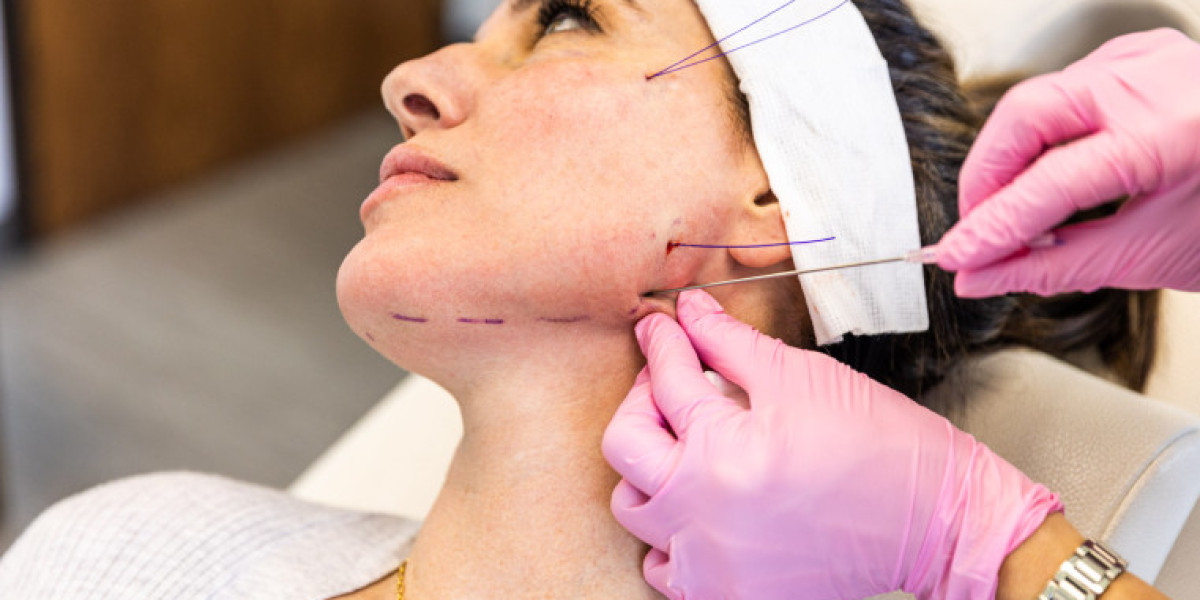Thread Lift in London: How Is Facial Skin Laxity Assessed During Consultation?