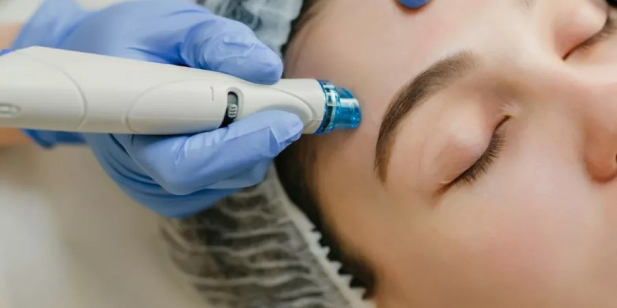 Pigmentation Laser Treatment in Gurgaon for Clearer-Looking Skin
