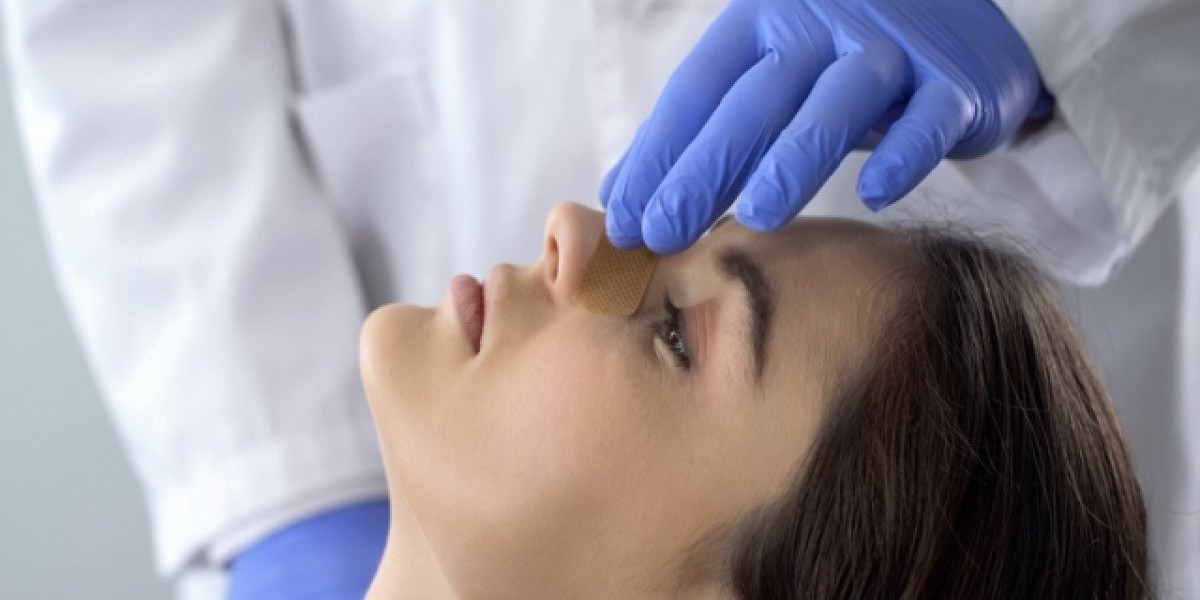 Rhinoplasty Surgery in Dubai: Before Surgery Checklist