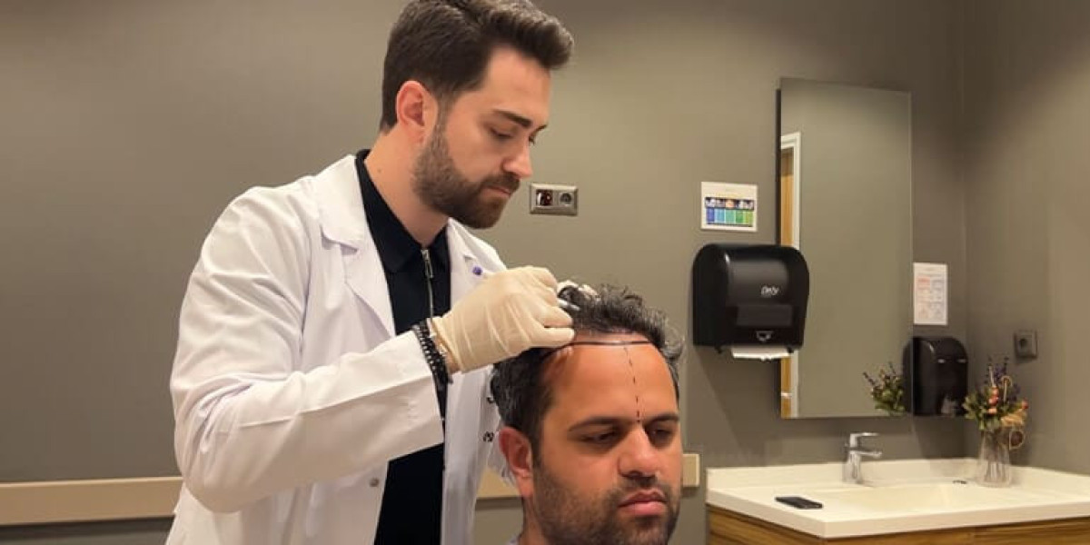 Hair Transplant in Dubai: How Natural Results Are Created