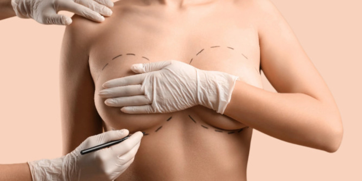 Mia Breast Implant In Dubai: Advanced Mia Breast Enhancement Solutions