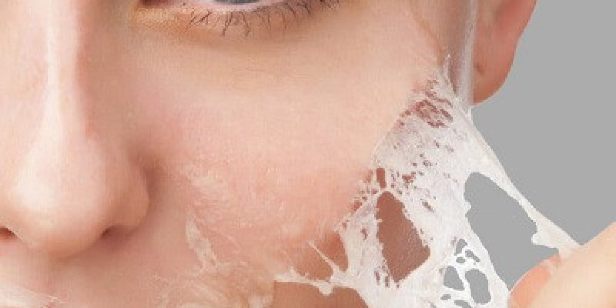 Chemical Peel vs. Laser Treatment: Key Differences & How to Choose