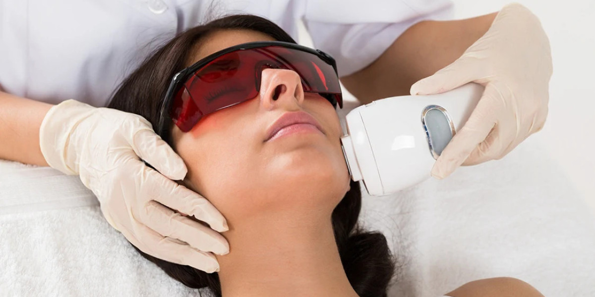 Can Laser Hair Bleaching provide natural-looking results?