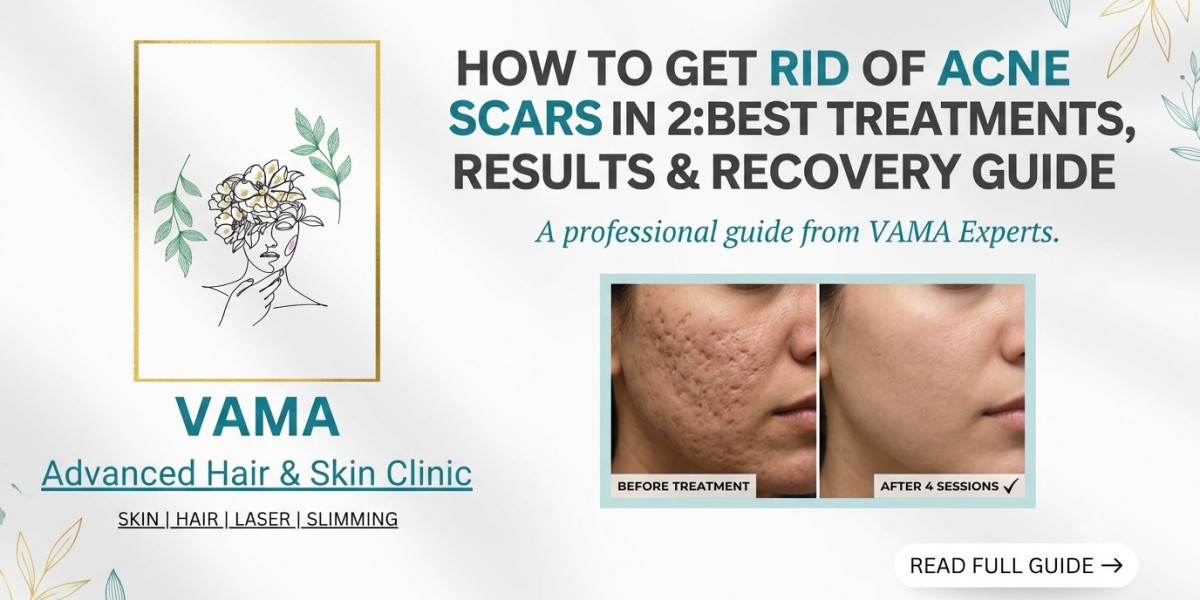 How to Get Rid of Acne Scars in 2026: Best Treatments, Results & Recovery Guide