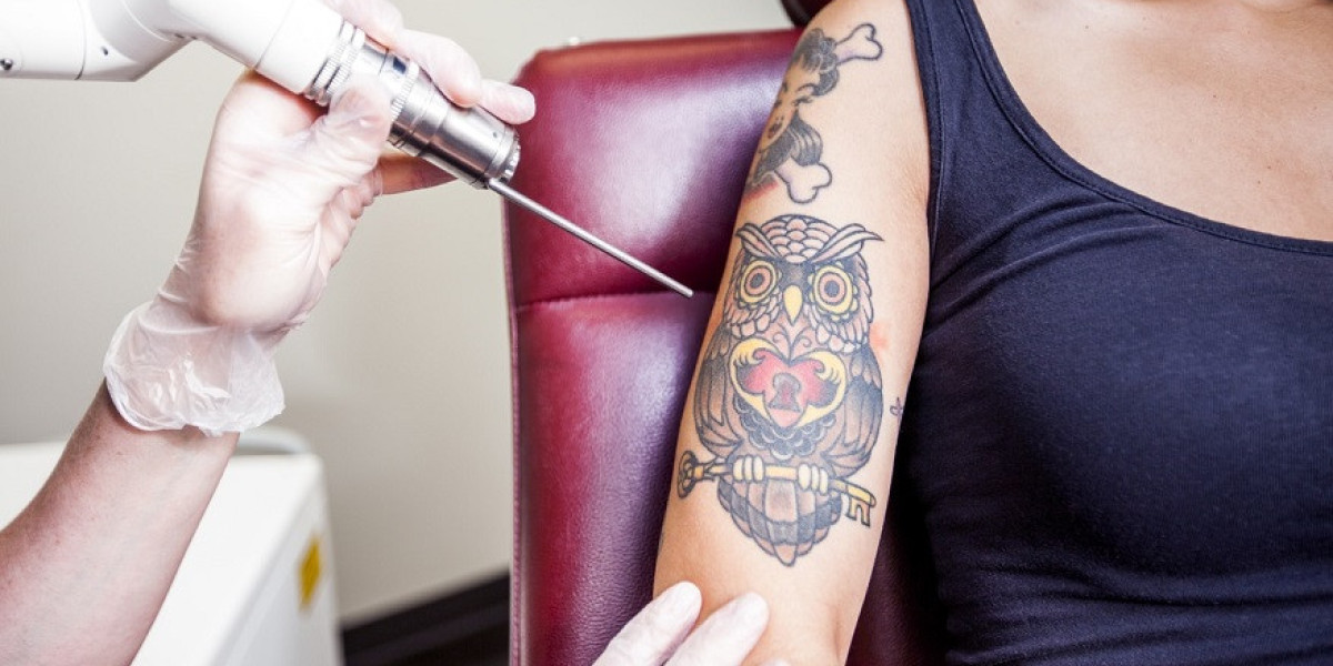 What happens during Laser Tattoo Removal Treatment?
