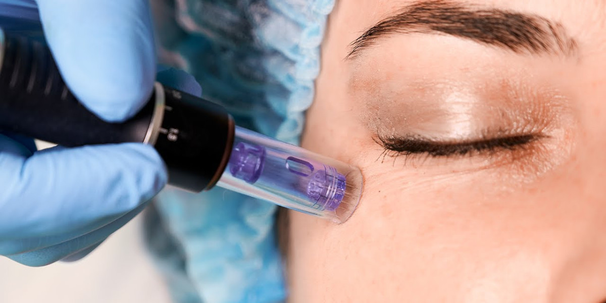 Microneedling Treatment in Dubai for Fine Lines