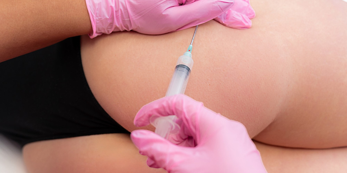 Can Butt Fillers Treatment be customized?