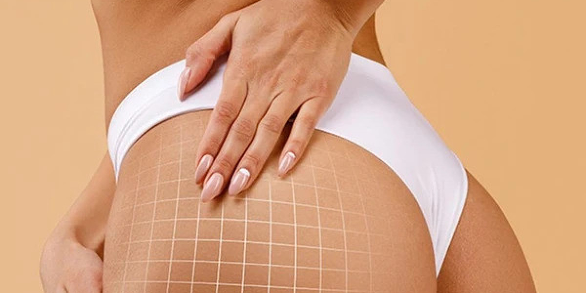 Butt Fillers In Dubai: Add Subtle Volume To Your Curves