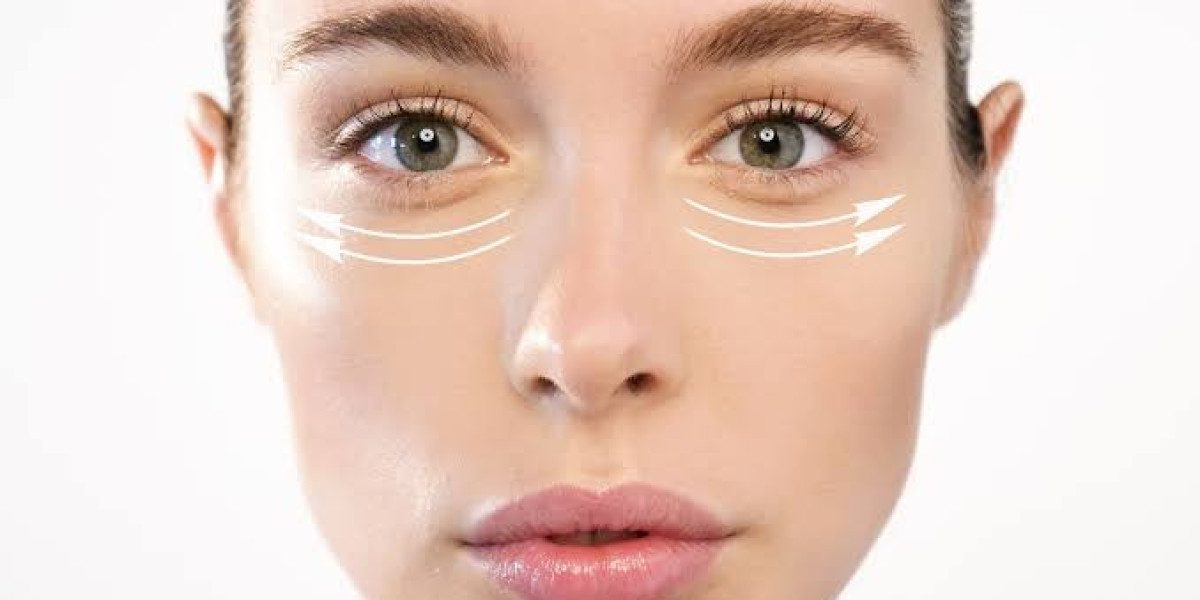 Can Eye Bags Be Removed Permanently?