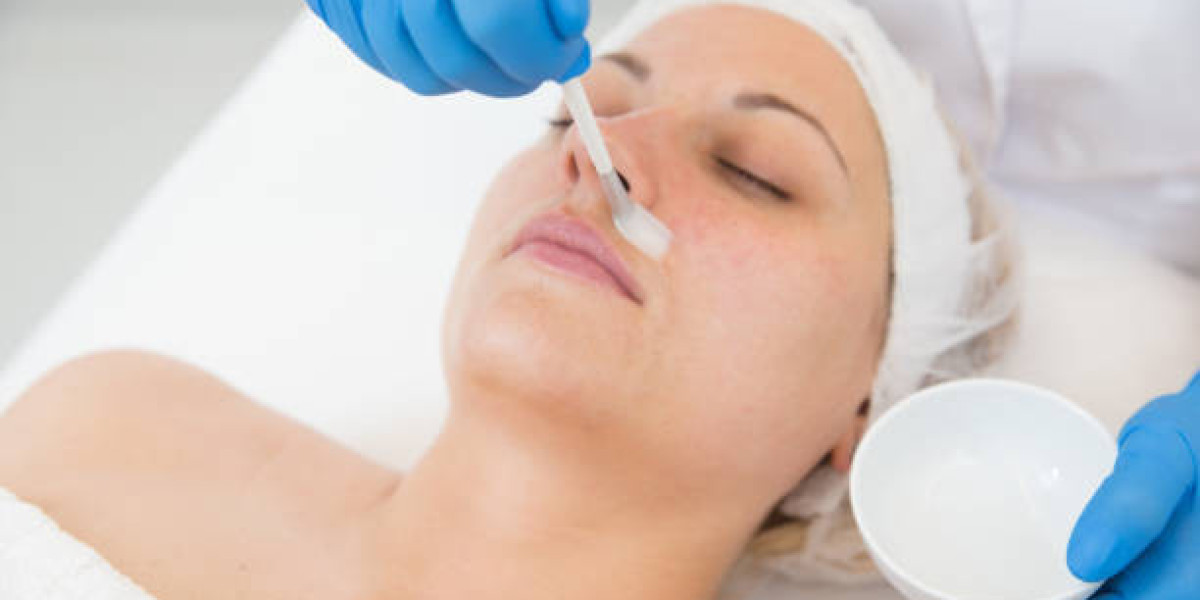 Chemical Peels in Dubai for a Brighter Complexion